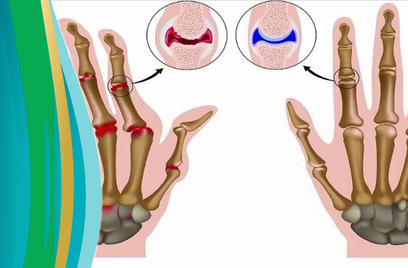 Tinh dầu sả có công dụng gì cho sức khỏe?